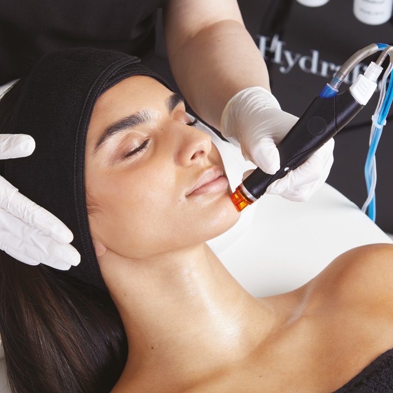 Paciente recibiendo tratamiento HydraFacial en Clínica Aurea
