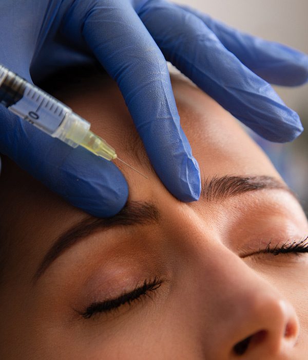 Aplicación de toxina botulínica en el rostro